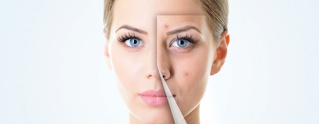 Leke Tedavisi - İzmir | Op. Dr. Rıza Aktaş